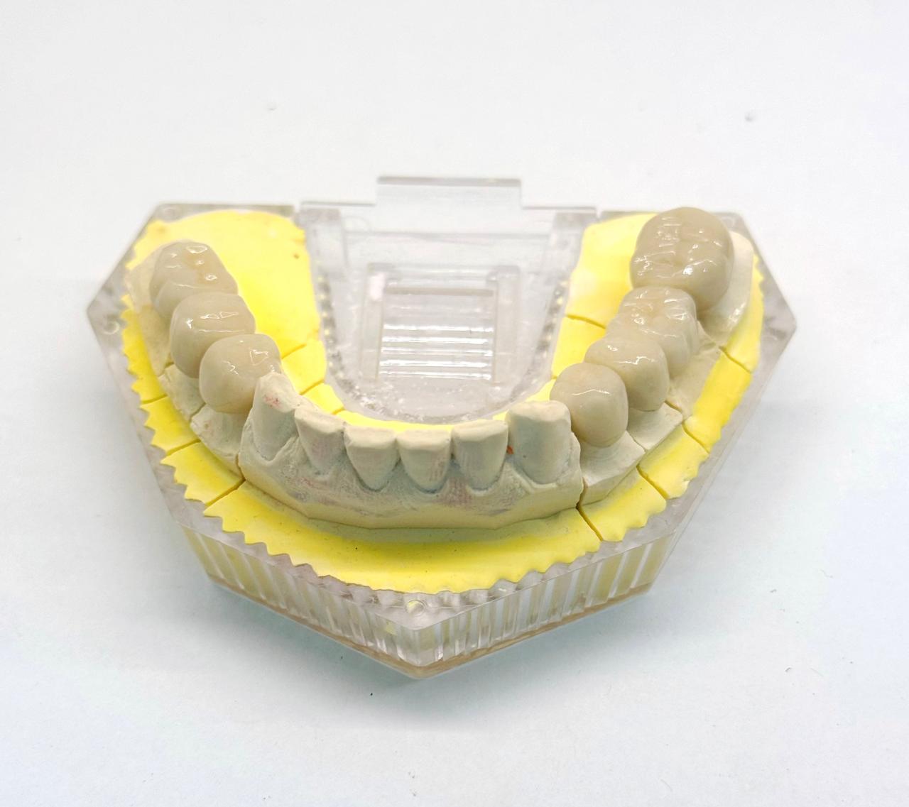 Зубные коронки в Китае