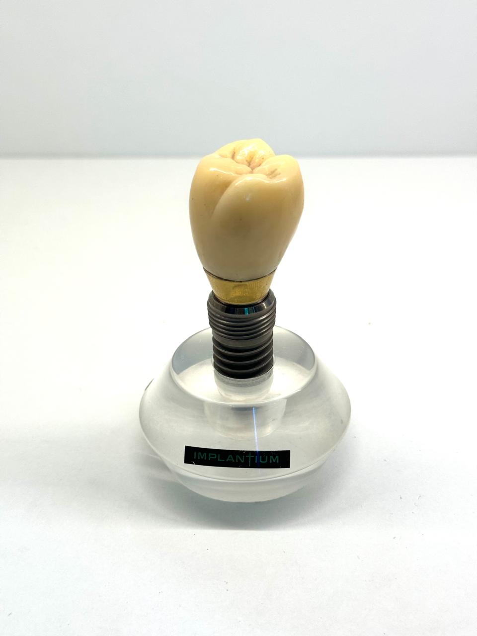 Имплантация зубов в Китае