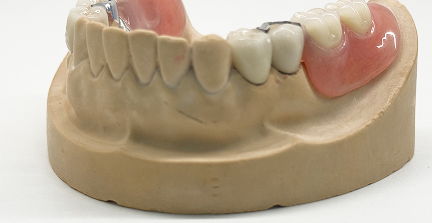 Съемные протезы в Китае