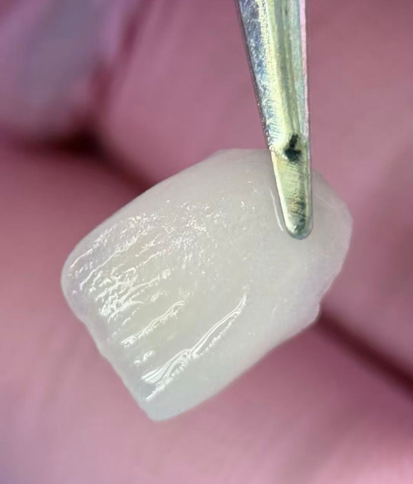 Виниры в Китае