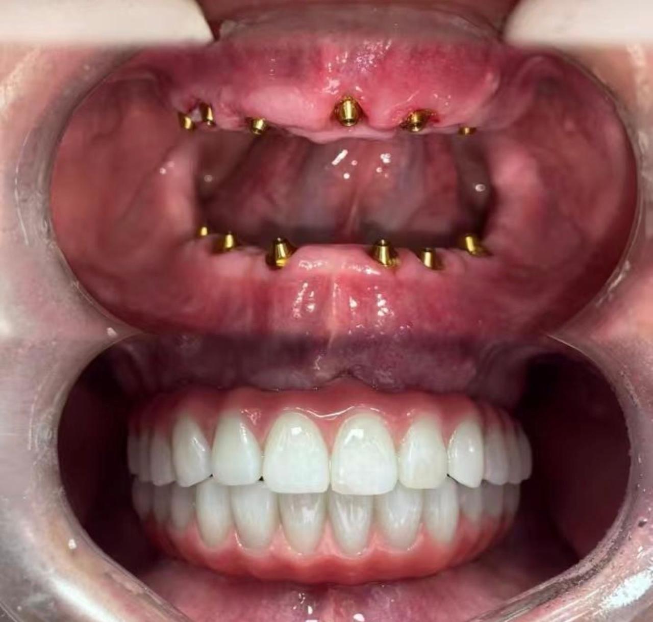 галерея изображения