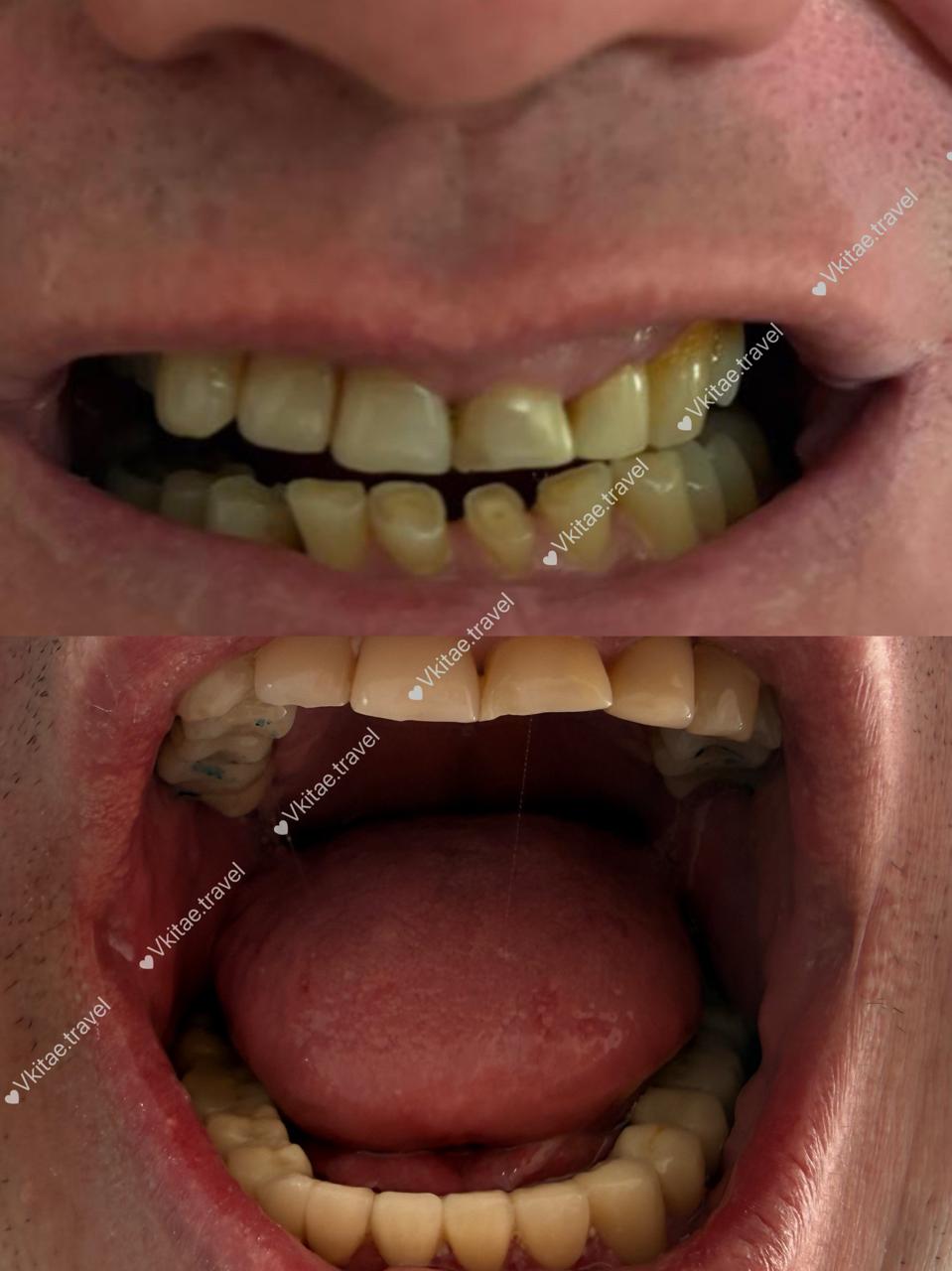 галерея изображения