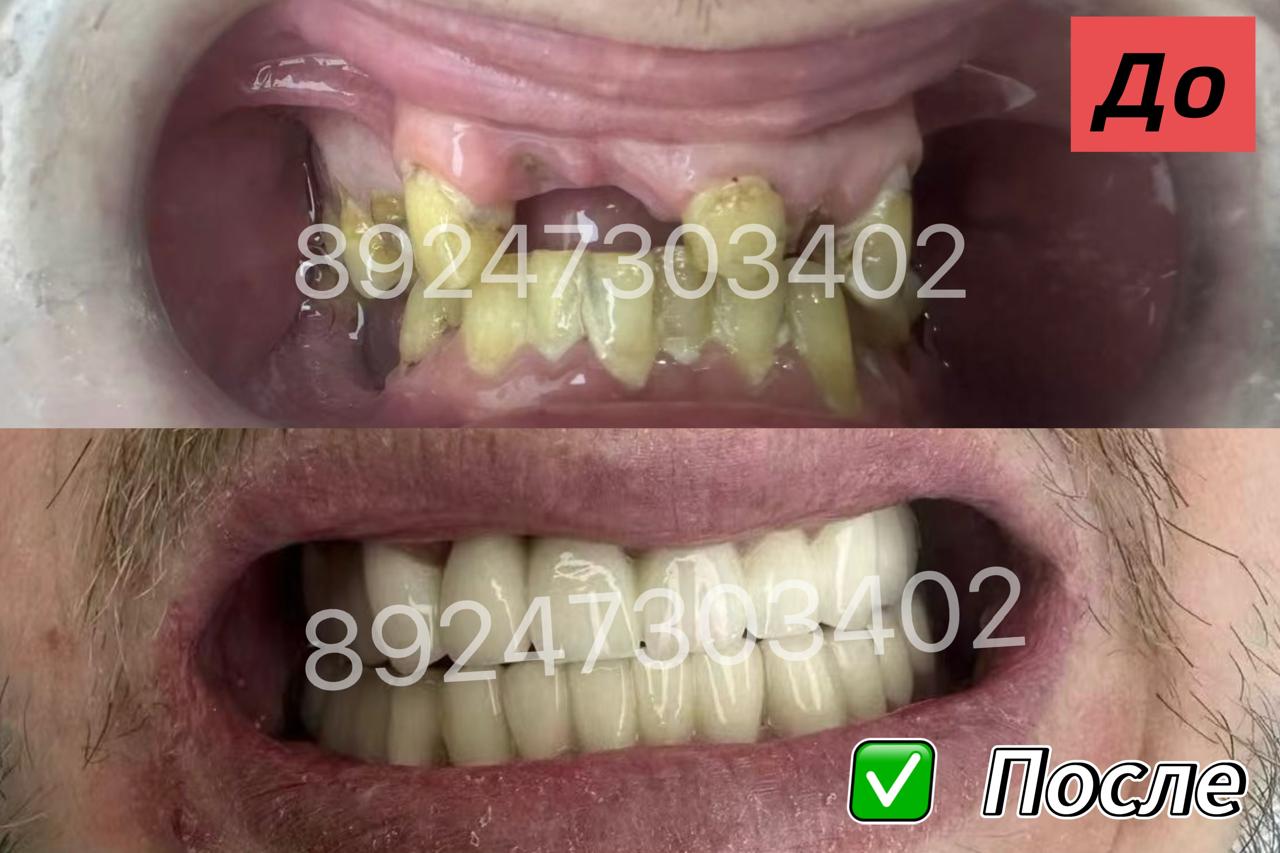 галерея изображения